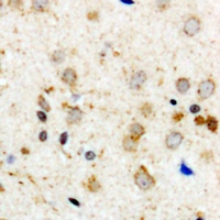Aconitase 1 (Phospho-S711) Antibody