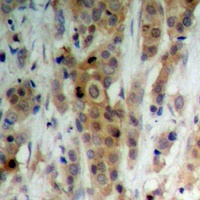 AKT (Phospho-S246) Antibody