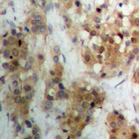 APC Rabbit Polyclonal Antibody (APC)