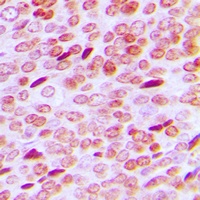 Androgen Receptor (Phospho-S213) Antibody