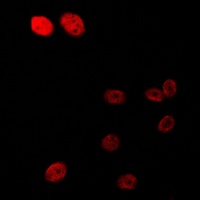 Androgen Receptor (Phospho-S213) Antibody