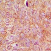 RhoGDI alpha (Phospho-S174) Antibody
