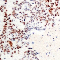 ATF2 (Phospho-T71) Rabbit Polyclonal Antibody