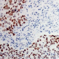 ATF2 (Phospho-T73) Antibody