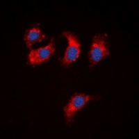 ATP7B Antibody