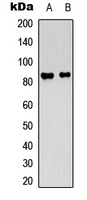 Ataxin 1 Rabbit Polyclonal Antibody