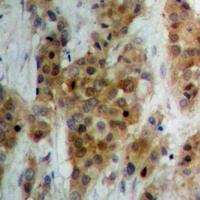 Ataxin 1 Rabbit Polyclonal Antibody