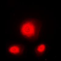 Ataxin 1 Rabbit Polyclonal Antibody