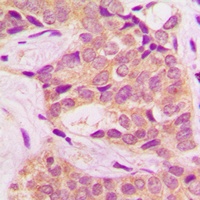 BCR (Phospho-Y360) Antibody