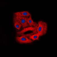 BCR (Phospho-Y360) Antibody