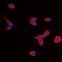 BDKRB1 Rabbit Polyclonal Antibody