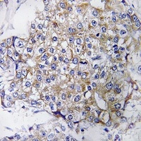Complement C1QB Antibody