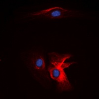 Complement C1QB Antibody