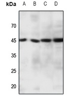 CCR11 Rabbit Polyclonal Antibody