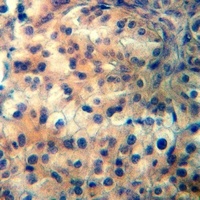 CCR11 Rabbit Polyclonal Antibody