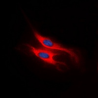 CCR11 Rabbit Polyclonal Antibody
