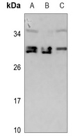 CDCA4 Rabbit Polyclonal Antibody