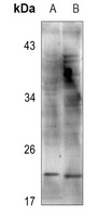 Cofilin Antibody