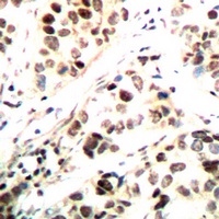 CHK1 (Phospho-S296) Rabbit Polyclonal Antibody