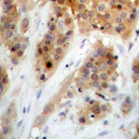CHK1 (Phospho-S345) Antibody