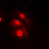 CHK1 (Phospho-S345) Antibody