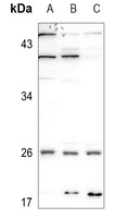 CMPK1 Rabbit Polyclonal Antibody