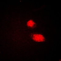 CMPK1 Rabbit Polyclonal Antibody