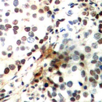 CREB (Phospho-S142) Antibody