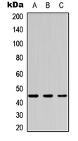 CK2 alpha Rabbit Polyclonal Antibody