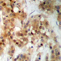 CK2 alpha Rabbit Polyclonal Antibody