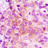 Catenin delta 1 (Phospho-Y228) Antibody