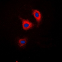 Catenin delta 1 (Phospho-Y228) Antibody