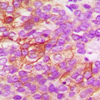 CD182 (Phospho-S347) Antibody