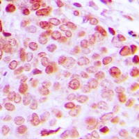 DDX5 (Phospho-Y593) Antibody