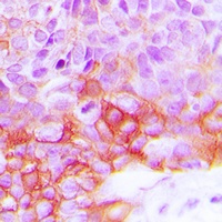 EGFR (Phospho-Y1092) Rabbit Polyclonal Antibody