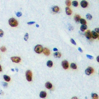 ELK1 (Phospho-T417) Antibody