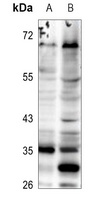 ELOVL5 Antibody