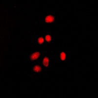 Estrogen Receptor beta (Phospho-S105) Rabbit Polyclonal Antibody