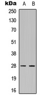 FADD Rabbit Polyclonal Antibody