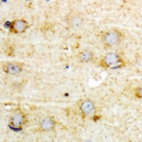 GFAP (Phospho-S38) Antibody