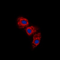 GFAP (Phospho-S38) Antibody