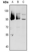 GPR101 Rabbit Polyclonal Antibody