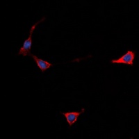 GPR101 Rabbit Polyclonal Antibody
