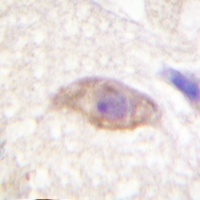 NMDAR2B (Phospho-Y1474) Antibody