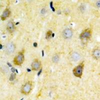 NMDAR2B (Phospho-Y1336) Antibody