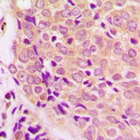 GSK3 alpha Rabbit Polyclonal Antibody