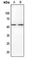 Histone Deacetylase 3 (Phospho-S424) Antibody