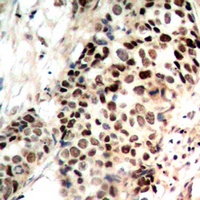 Histone Deacetylase 3 (Phospho-S424) Antibody