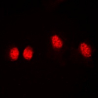 Histone Deacetylase 3 (Phospho-S424) Antibody