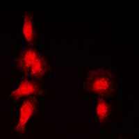 Histone Deacetylase 7 (Phospho-S155) Rabbit Polyclonal Antibody